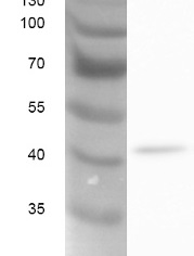MIP1 | Aquaporin, glycerol transport activity in the group Antibodies Plant/Algal / Chlamydomonas reinhardtii at Agrisera AB (Antibodies for research) (AS15 2826)